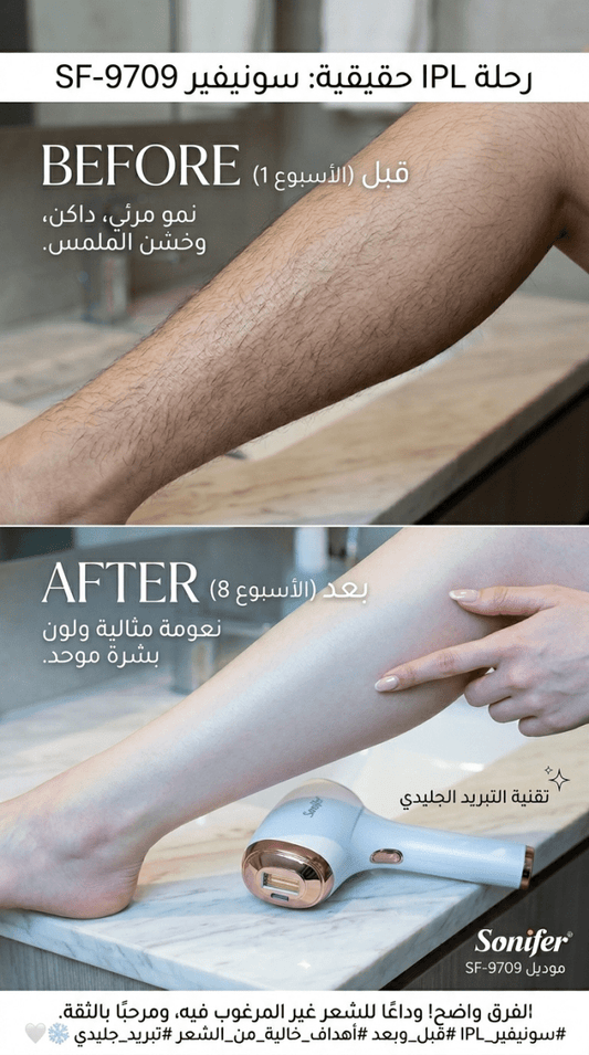SF-9709. مزيل الشعر بالليزر Sonifer IPL Hair Remover تقنية تبريد عالية الجودة - Rekaz Home